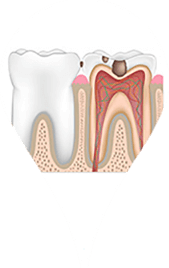 細菌、毒素感染