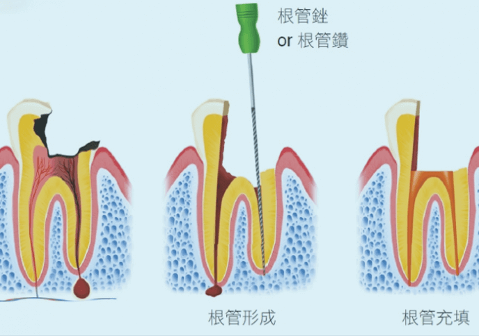 珠海杜牙根