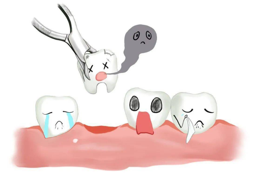 珠海拔牙,為什麼有些人拔牙之後會發燒?