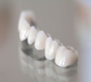 珠海牙科—烤瓷牙冠單冠與連冠有什麼區別？