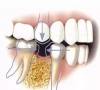 珠海牙科—缺牙對我們身體有什麼危害？