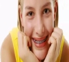 珠海牙科—兒童箍牙要特別注意什麼？