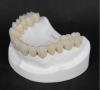 珠海牙科-什麼是全口義齒？