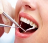 珠海牙科-洗牙會不會感染傳染病？