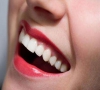 珠海牙冠—為什麼戴烤瓷牙吃飯會痛？