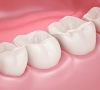 珠海牙科科普-什麼是牙的正常顏色？什麼樣的牙顏色是異常的？