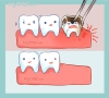 珠海牙科—智齒冠周炎怎麼辦？
