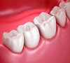 珠海牙科-牙齒發黃需要做什麼？