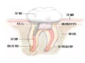 珠海杜牙根，點樣判斷蛀牙到牙神經？