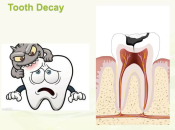 蛀牙點解會影響身體健康咧？澳門過珠海補牙要幾錢？