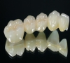 珠海牙科—牙齒缺損怎麼治療？