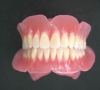 珠海牙科—全口牙齒脫落後的修復選擇