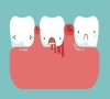 珠海牙科-牙齒鬆動是怎麼回事？