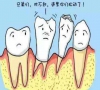 珠海牙周治療—為什麼牙周炎會導致牙齒鬆動？