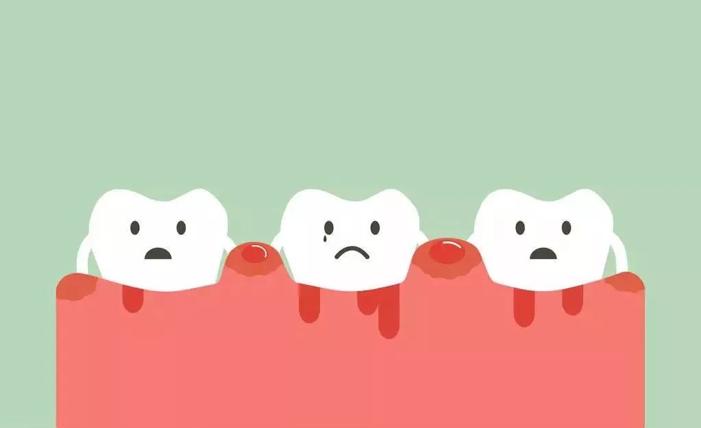 為什麼會患牙周病？
