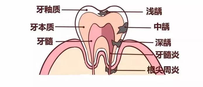 牙髓的組織學結構-珠海維港口腔連鎖