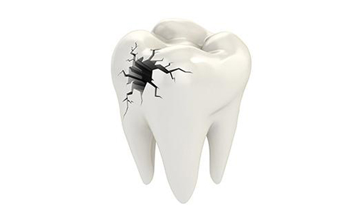 珠海牙科—牙髓炎会有什么发展？