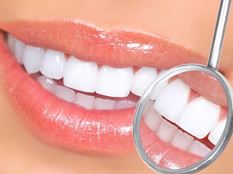 牙齒發黃的因素有哪些？