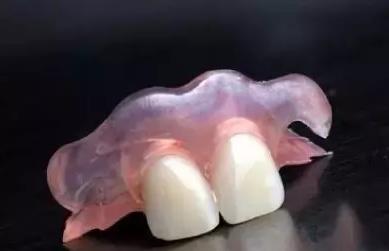 珠海牙科—什麼是隱形義齒？