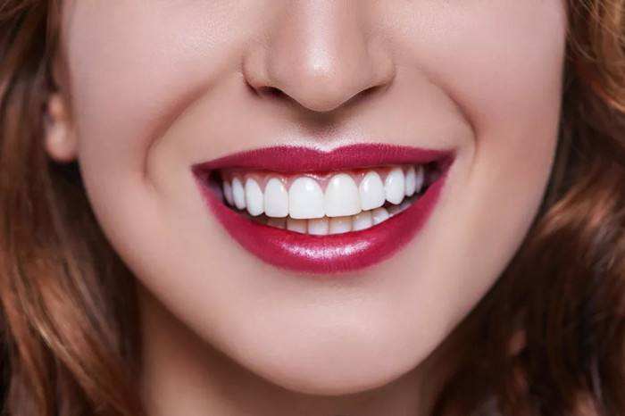 牙齒貼面是什麼有危害嗎？