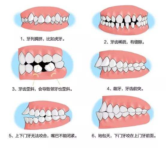 牙齿矫正1