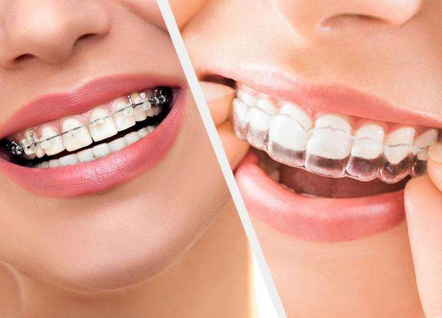 什麼是牙髓炎？