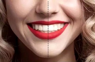 珠海牙科—什麼樣的牙齒才是“美"的？