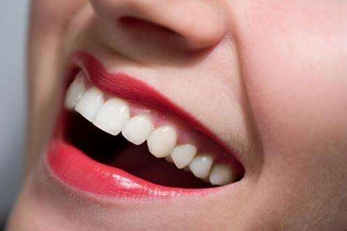 珠海牙齒貼面-瓷貼面修復牙體預備的原則