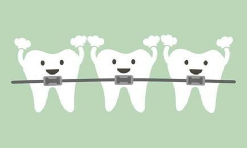 珠海牙科—箍牙一般大致可以分為哪幾個時間段？